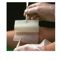Bactigras Smit & Nephew 10 Garze Medicate 10x10cm - farmavitality.it